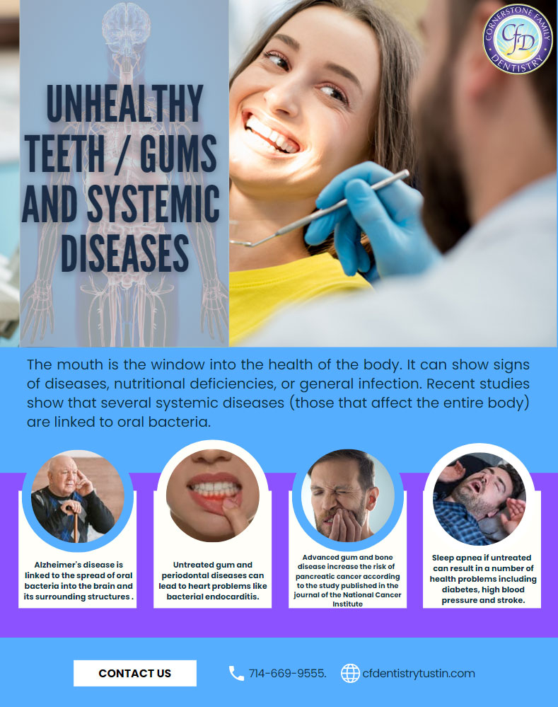 Dental Exam & Cleaning in Tustin